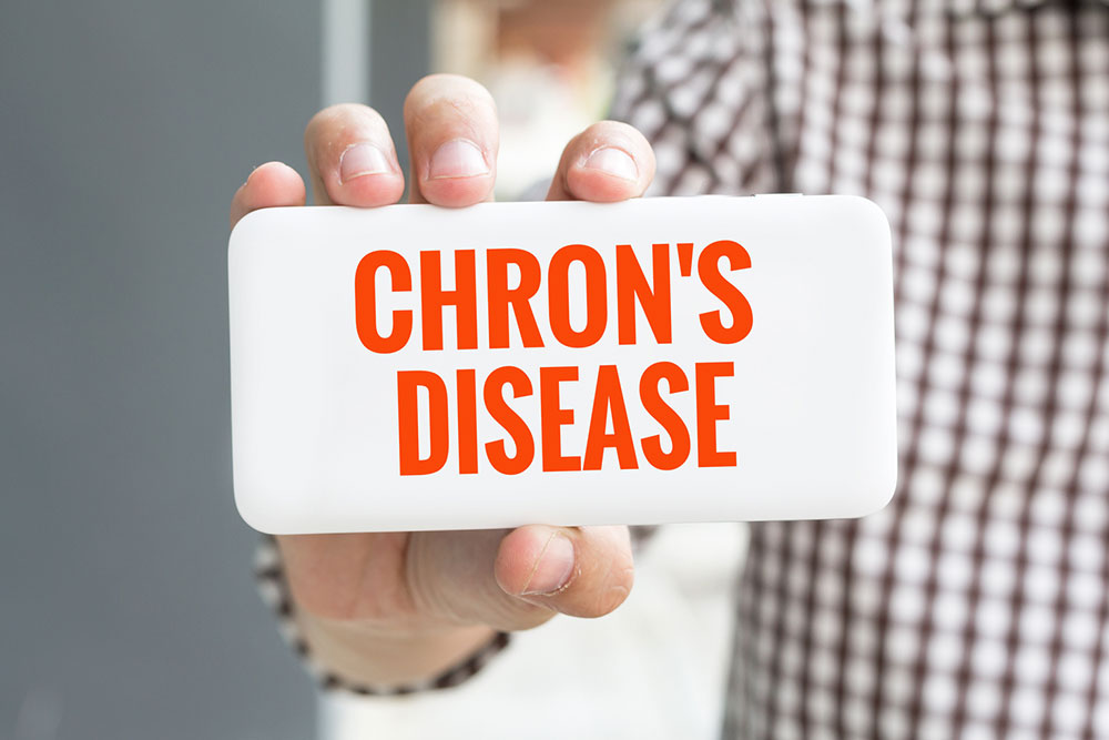 All You Need to Know about Chron’s disease